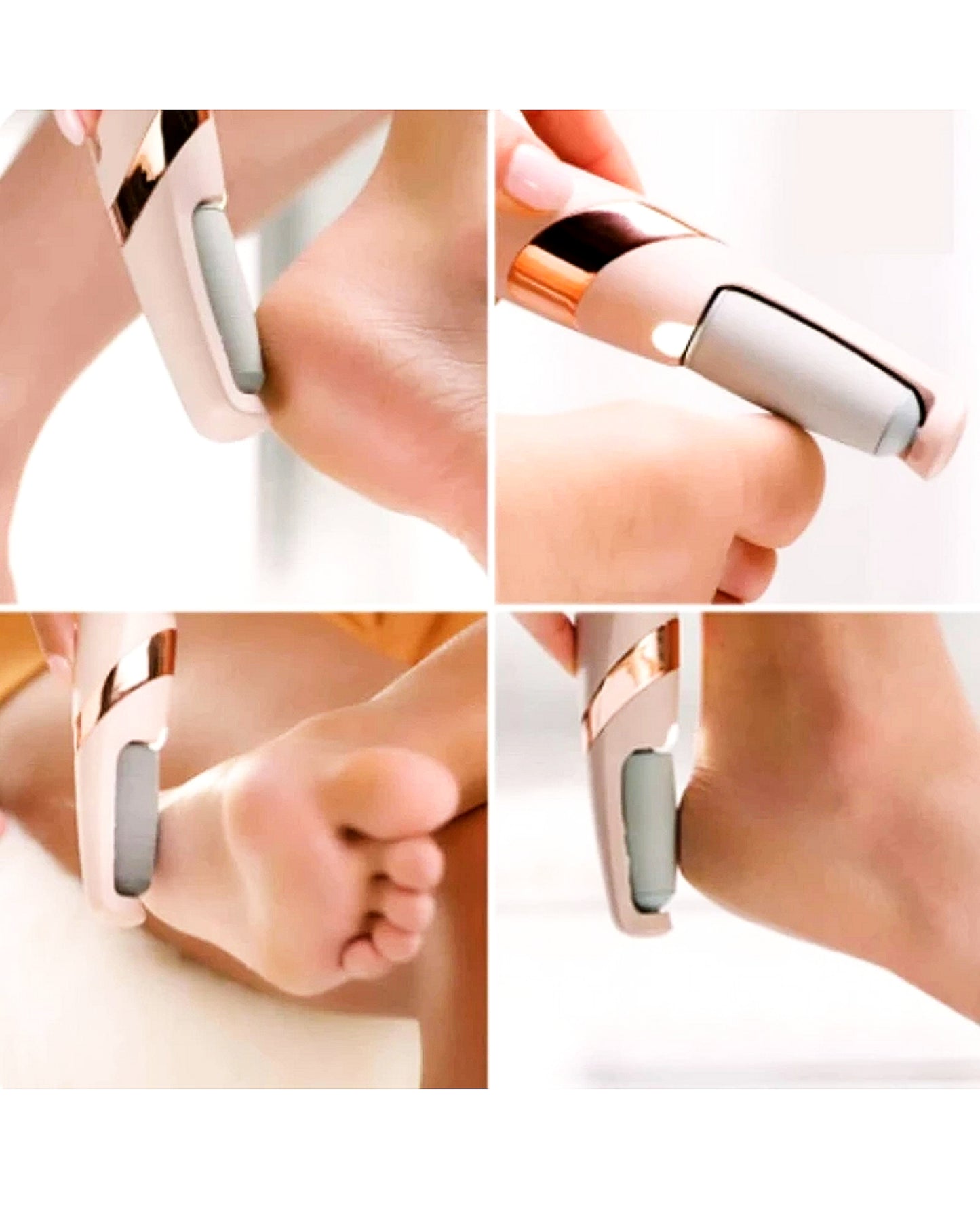 Rechargeable Electronic Pedicure Tool with 2 Roller Heads – Foot Callus Remover