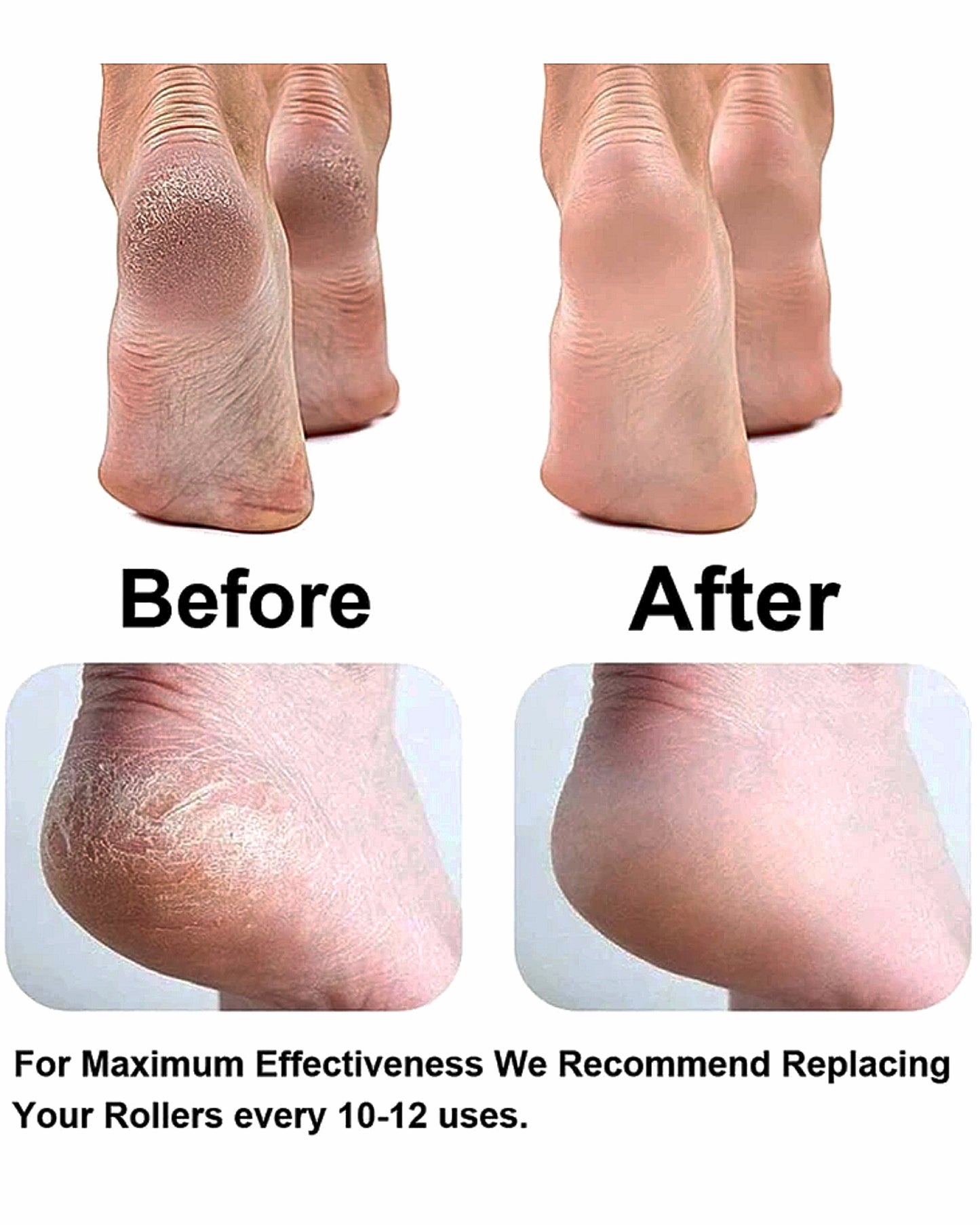 Rechargeable Electronic Pedicure Tool with 2 Roller Heads – Foot Callus Remover